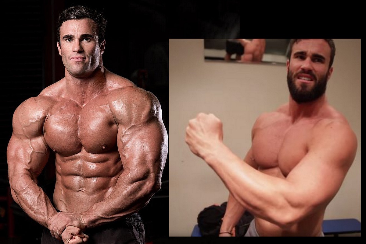 У Калума Фон Могера пострадала вся верхняя часть - Бодибилдинг форум AnabolicShops