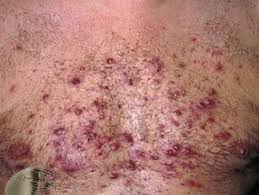 IndiaGenericPower- магазин ПКТ! - Бодибилдинг форум AnabolicShops