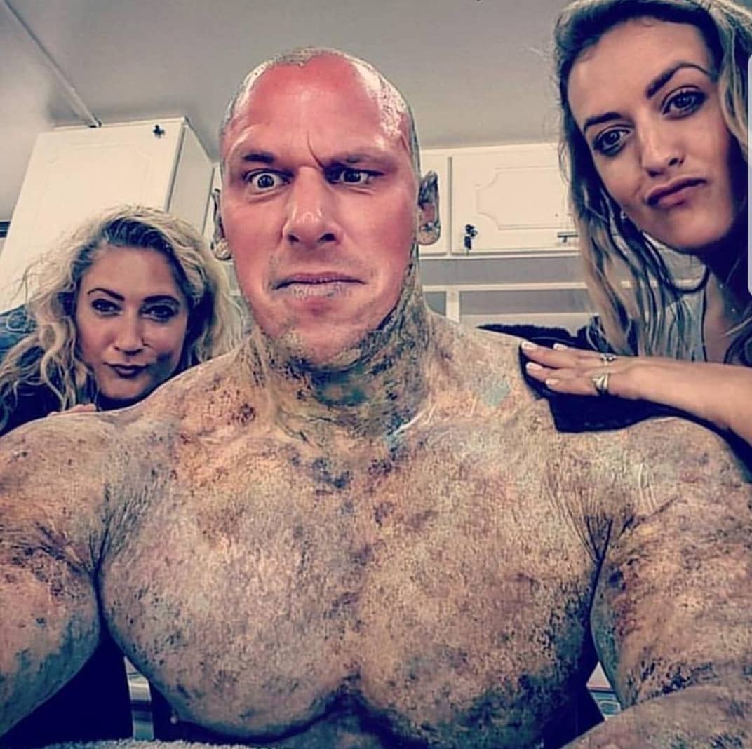 Мартин Форд, заменивший Рича Пиана в 5%, оказался в госпитале - Бодибилдинг форум AnabolicShops