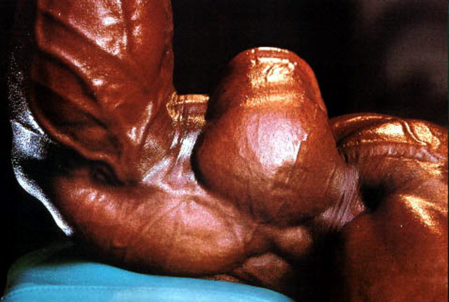 Разрыв бицепса - Бодибилдинг форум AnabolicShops