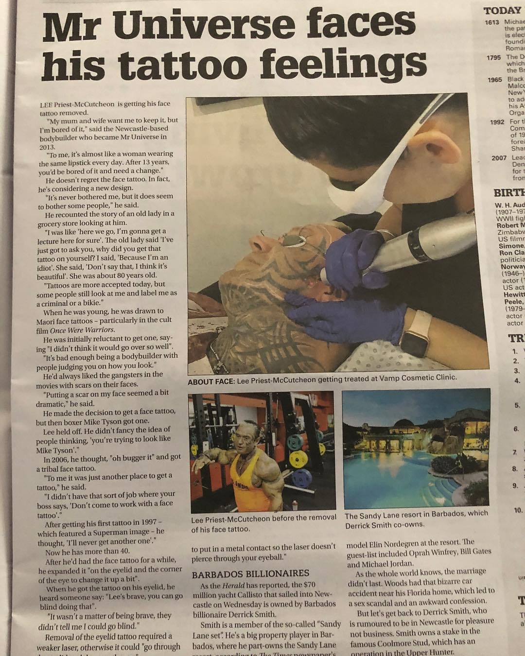 Ли Прист "сбривает" татуировку с лица самым мощным лазером в мире - Бодибилдинг форум AnabolicShops