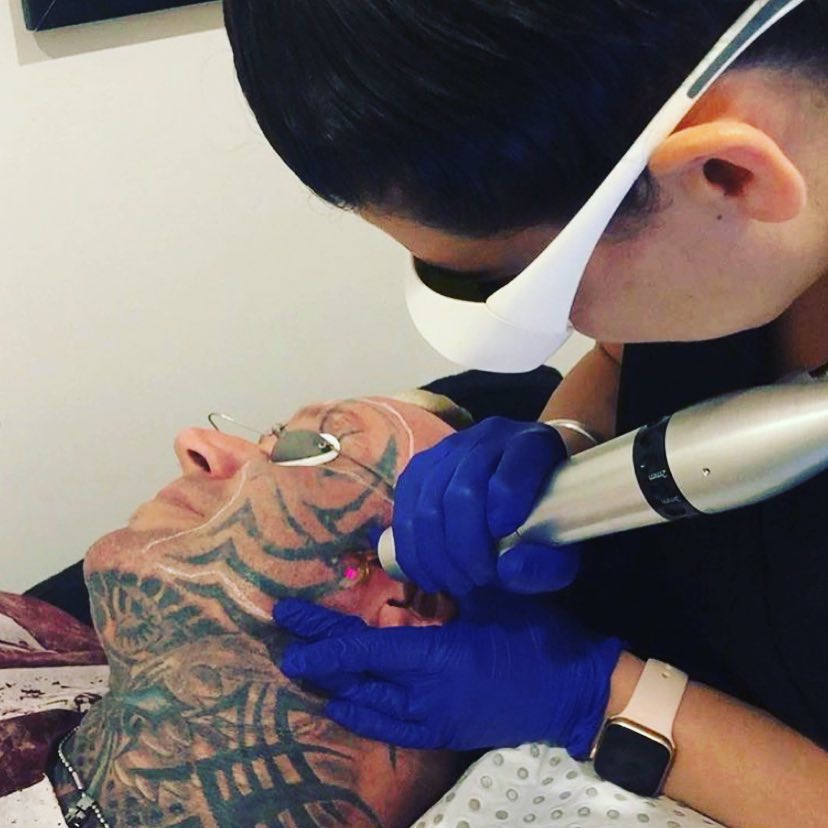 Ли Прист "сбривает" татуировку с лица самым мощным лазером в мире - Бодибилдинг форум AnabolicShops