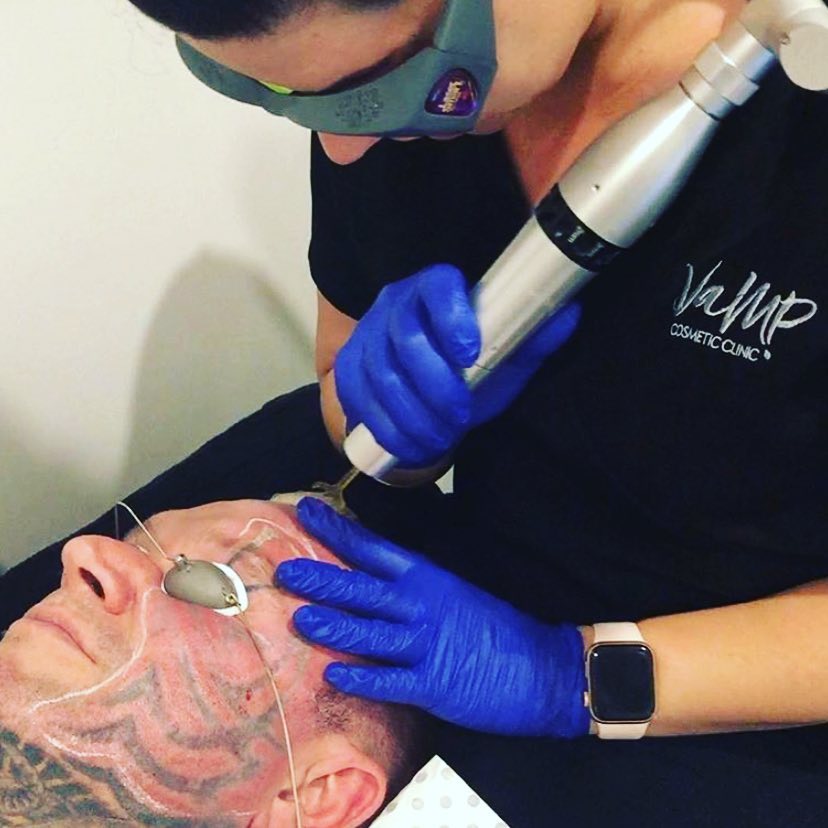 Ли Прист "сбривает" татуировку с лица самым мощным лазером в мире - Бодибилдинг форум AnabolicShops