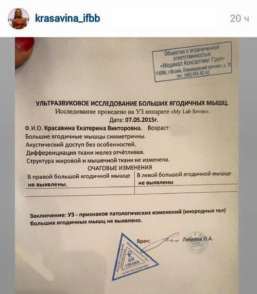 Фитнес бикини Екатерина Красавина не делала пластику ягодиц - Бодибилдинг форум AnabolicShops