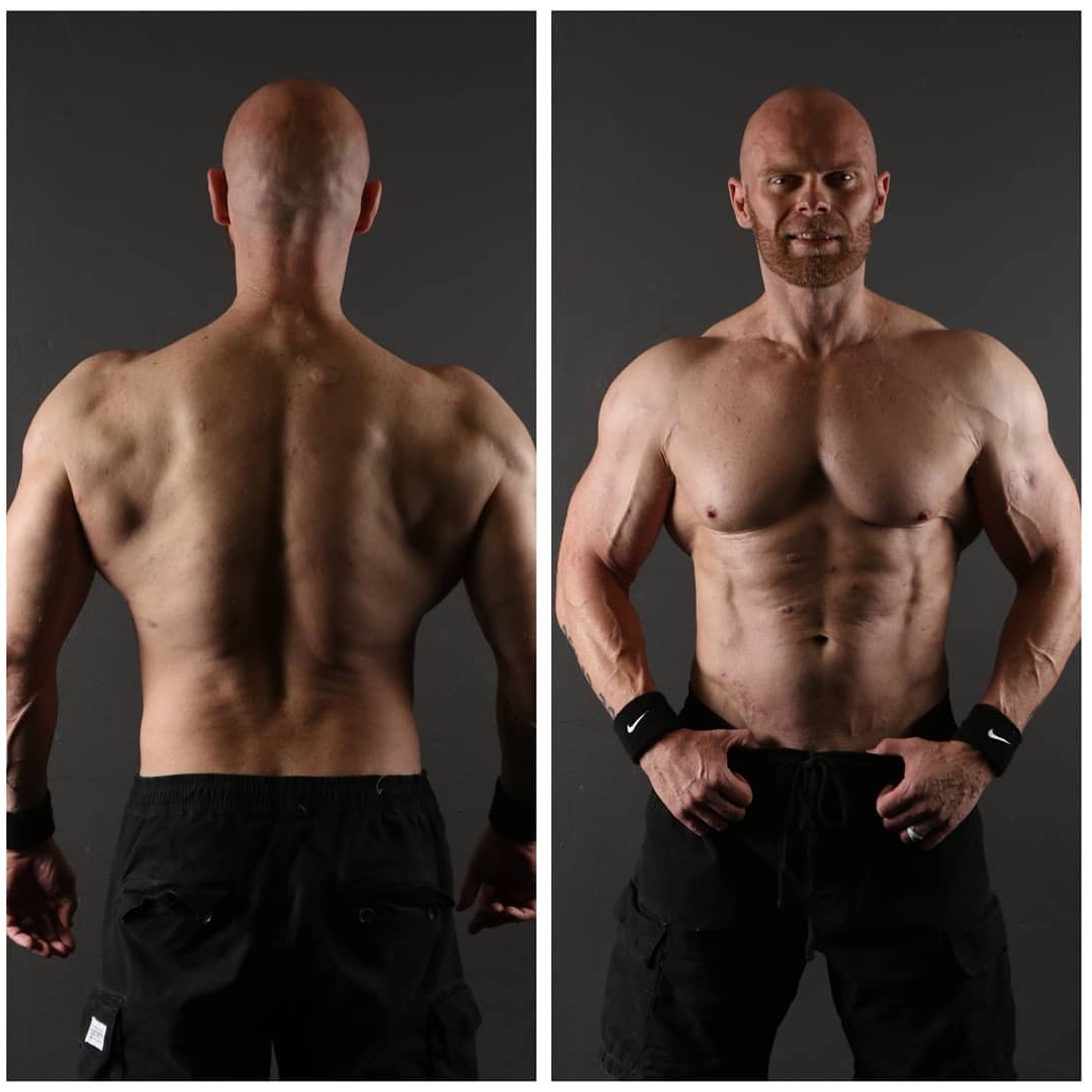 Почечная недостаточность 5-го уровня - не приговор про-бодибилдеру - Бодибилдинг форум AnabolicShops