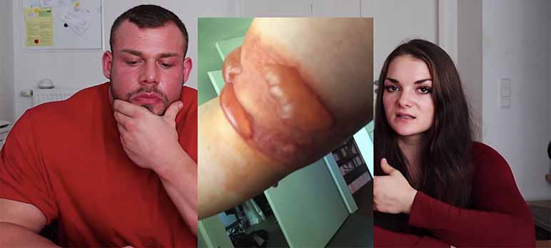 Медицина загубила про-атлетку IFBB FIGURE-PRO . 18+ - Бодибилдинг форум AnabolicShops