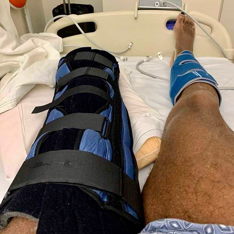 Показал отрезанную ногу и запретил о ней говорить - Бодибилдинг форум AnabolicShops