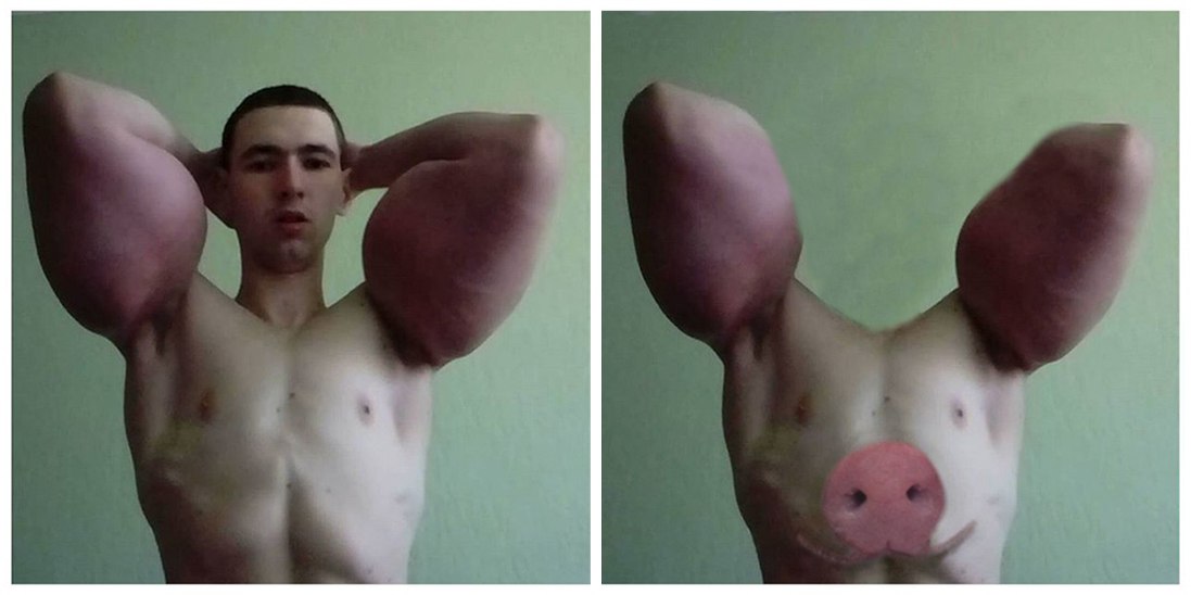 Руки-Базуки попросил об операции по удалению бицепсов из-за воспаления - Бодибилдинг форум AnabolicShops