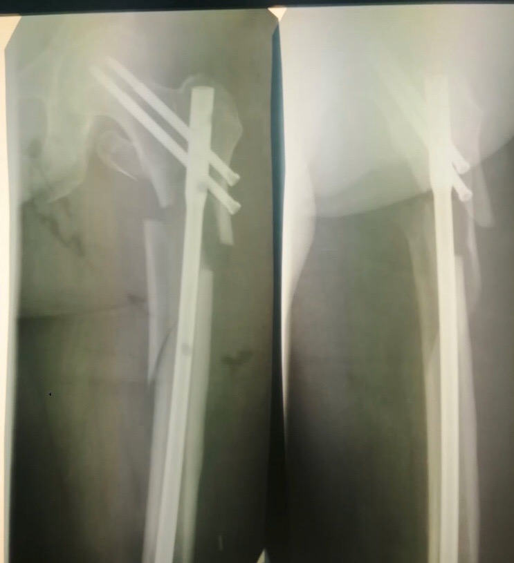 ПЖБ или путь жимовой бестолочи. - Бодибилдинг форум AnabolicShops