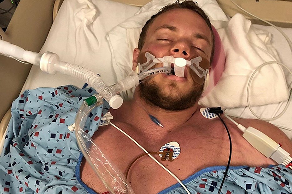 У абсолютного чемпиона с пульсом 260 проявились одновременно два порока серда - Бодибилдинг форум AnabolicShops