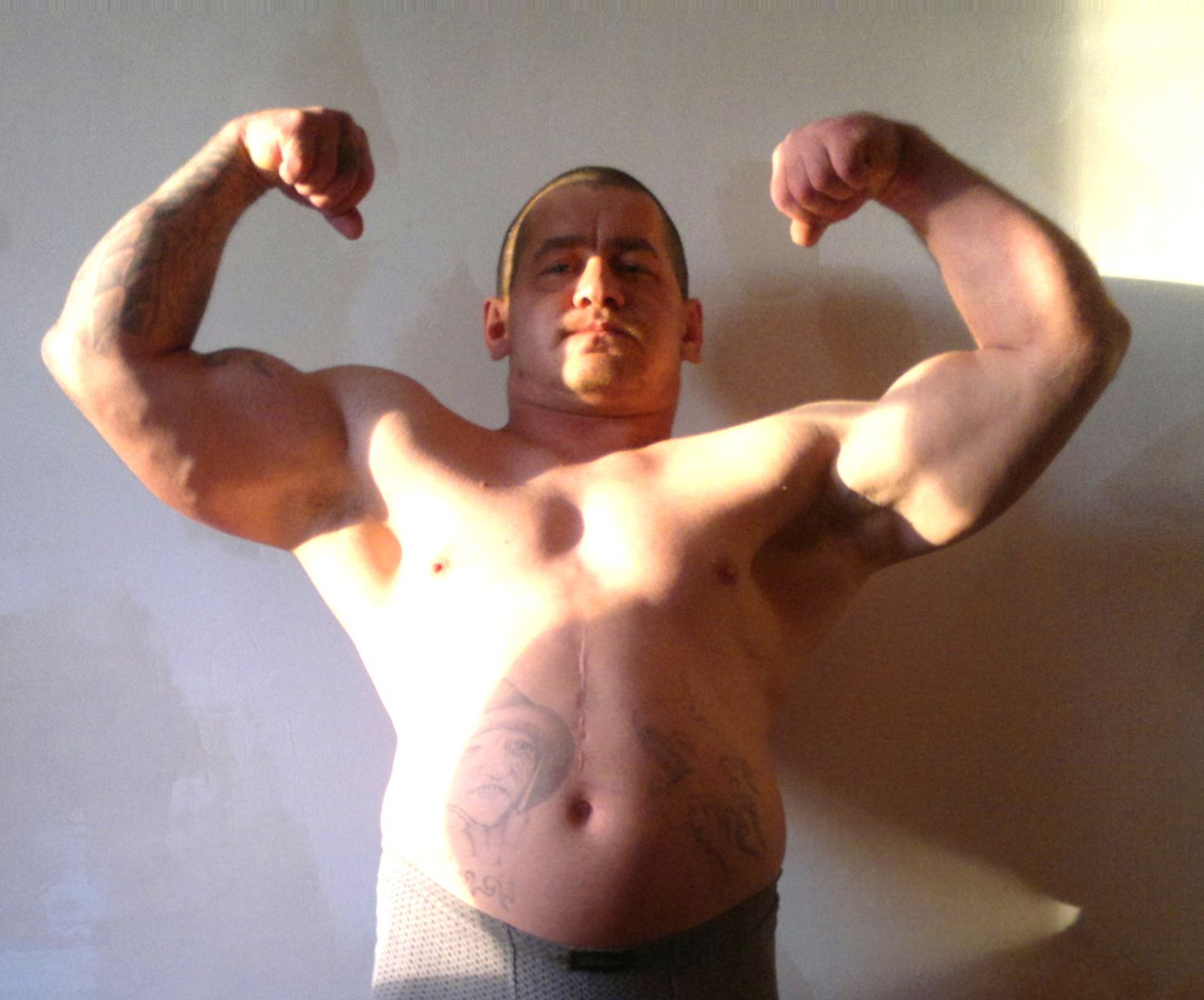 У фрик-бодибилдера Грегга Валентино рак - Бодибилдинг форум AnabolicShops