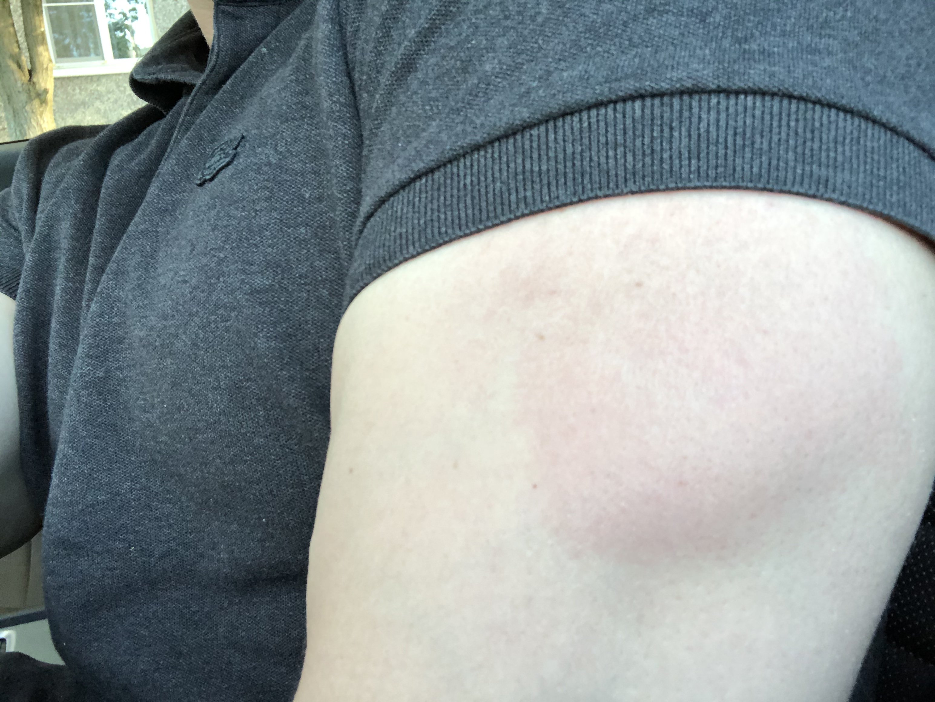 ZPHC - Бодибилдинг форум AnabolicShops