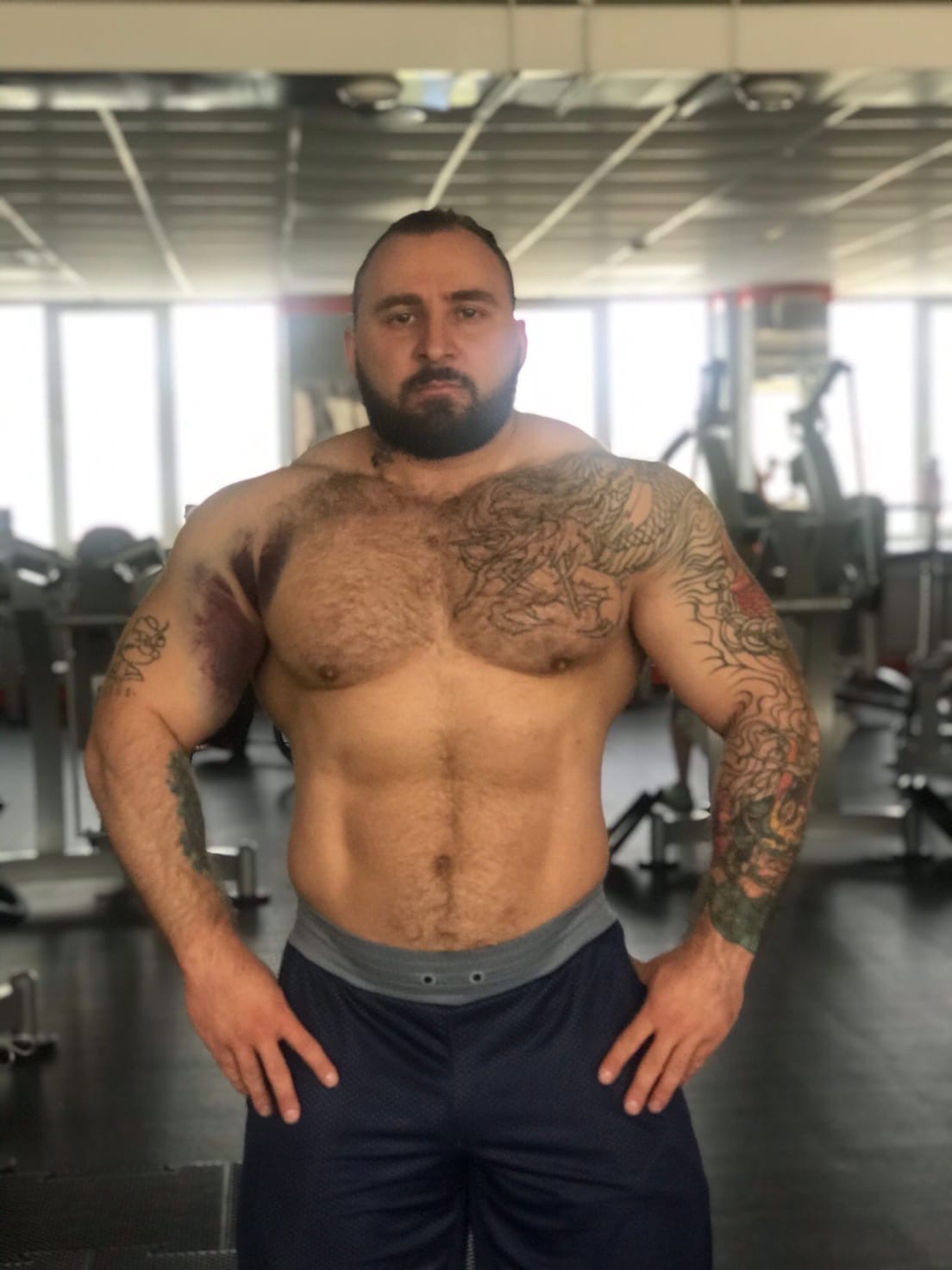 Как попытался увеличить жим на массанаборе и получил травму - Бодибилдинг форум AnabolicShops