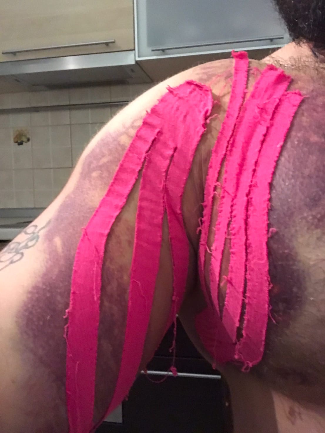 Как попытался увеличить жим на массанаборе и получил травму - Бодибилдинг форум AnabolicShops