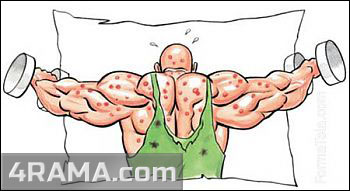 Прыщи от гейнера и протеина - Бодибилдинг форум AnabolicShops