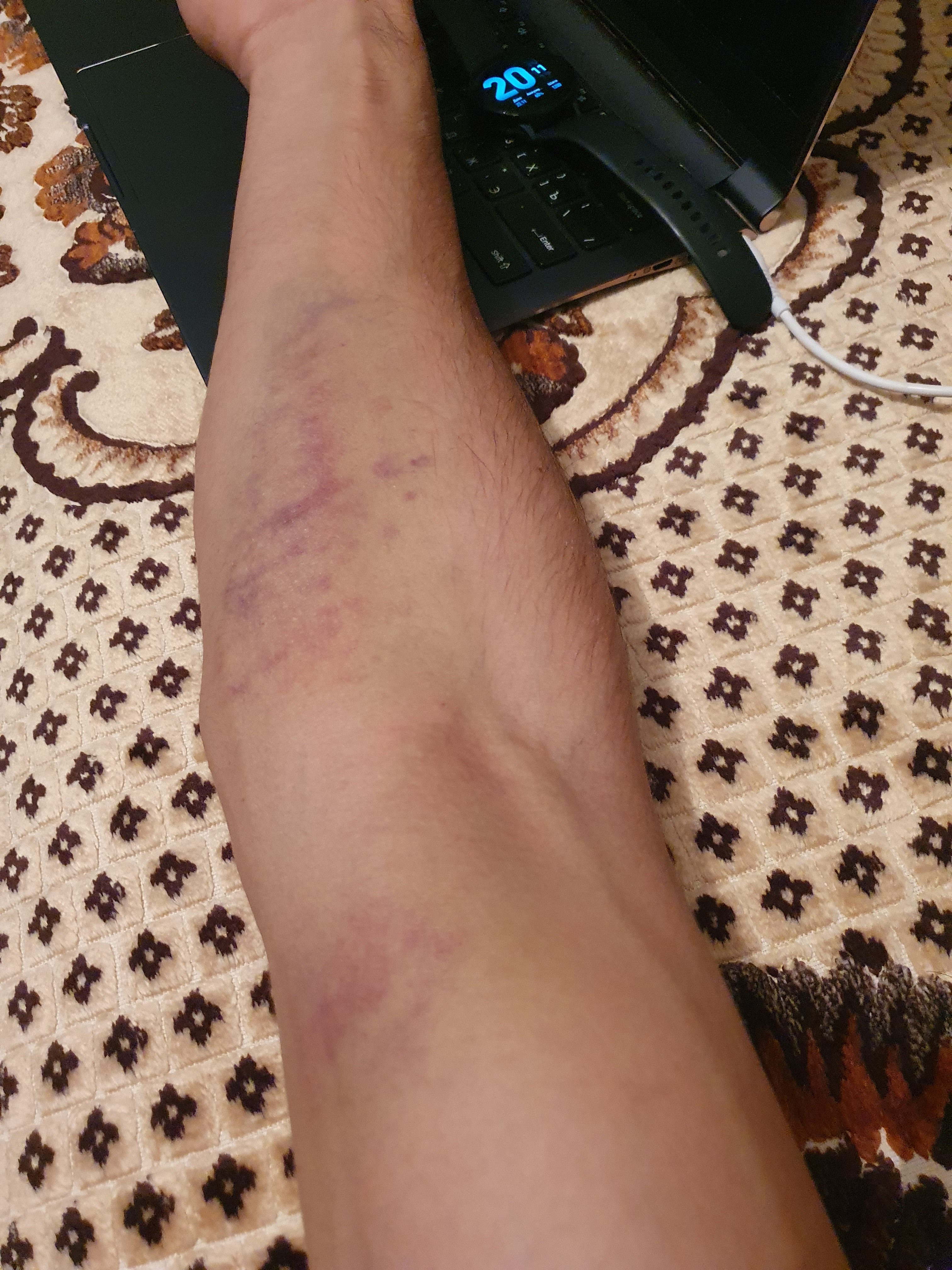 Армейский жим - Бодибилдинг форум AnabolicShops