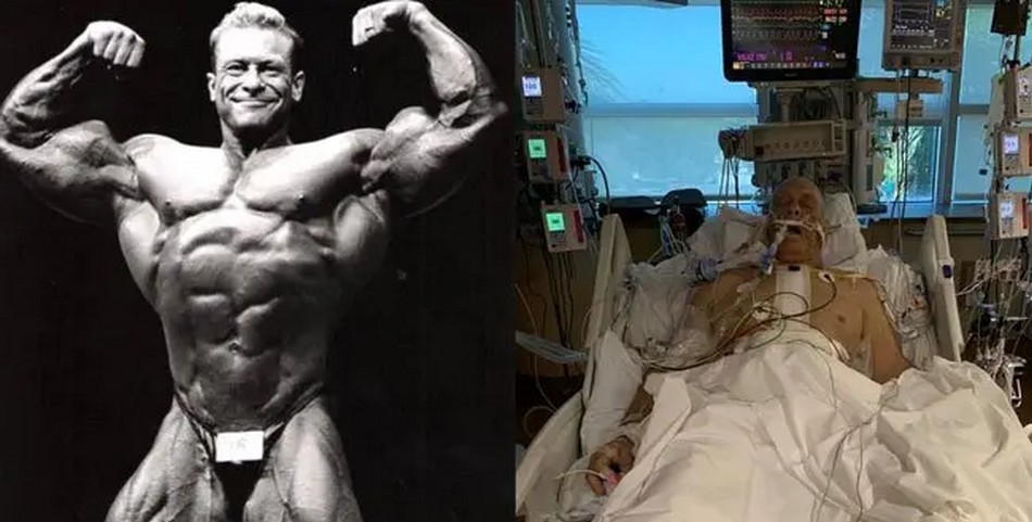 10 лет в бодибилдинге - 6 шунтирований вместо рефлюса в 51 год - Бодибилдинг форум AnabolicShops