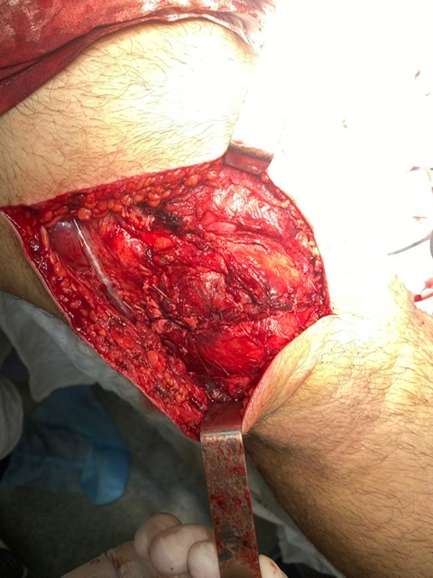 Зевякин Иван - тренировочный процесс/ питание/ фарм поддержка... - Бодибилдинг форум AnabolicShops