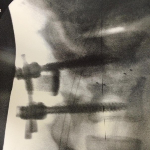 Ронни Коулмен в очередной раз оказался на операционном столе. - Бодибилдинг форум AnabolicShops