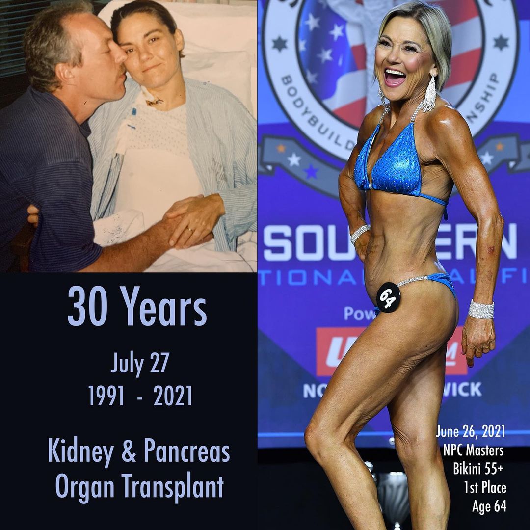 После двойной трансплантации органов на сцену турнира в 64 года - Бодибилдинг форум AnabolicShops