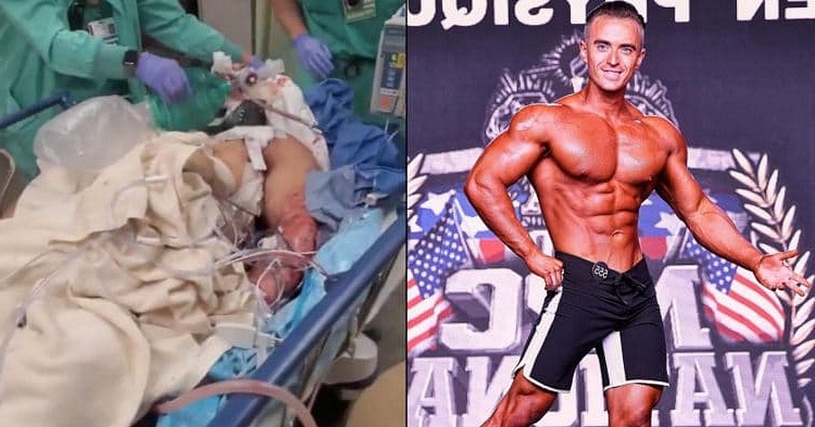 Сбила машина на кардио - бодибилдер в реанимации - Бодибилдинг форум AnabolicShops