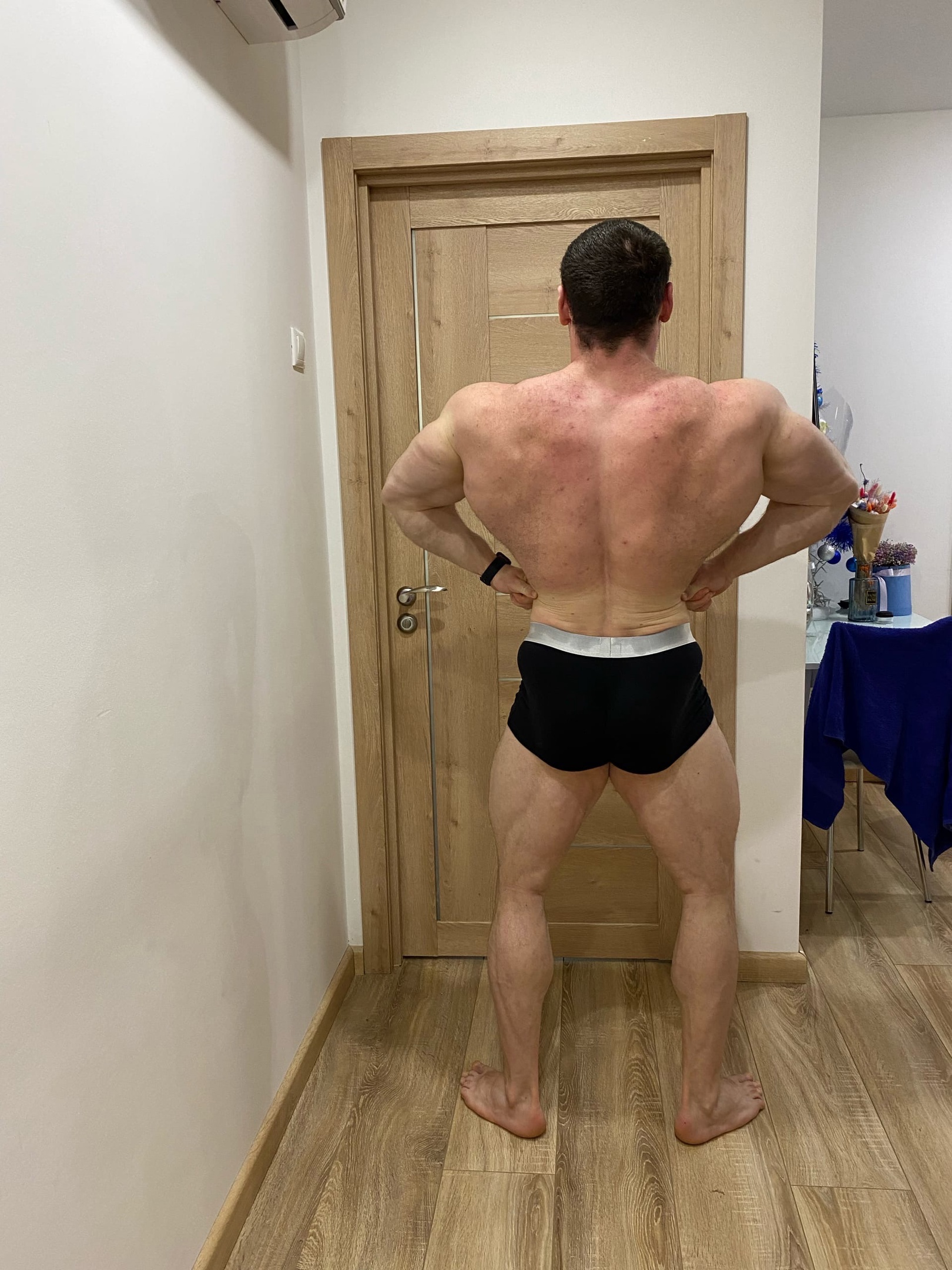 Что по форме после операции?! - Бодибилдинг форум AnabolicShops