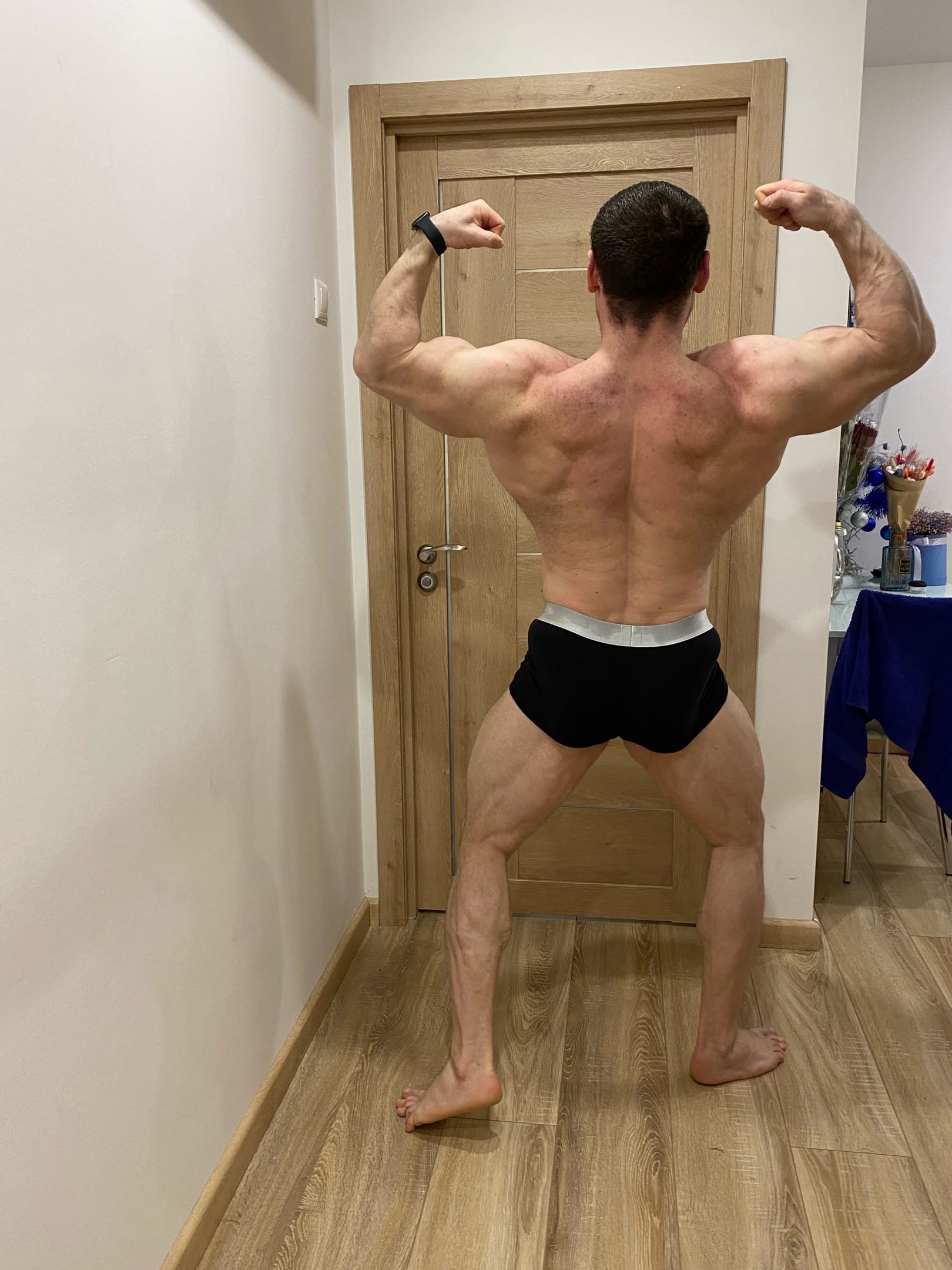 Что по форме после операции?! - Бодибилдинг форум AnabolicShops