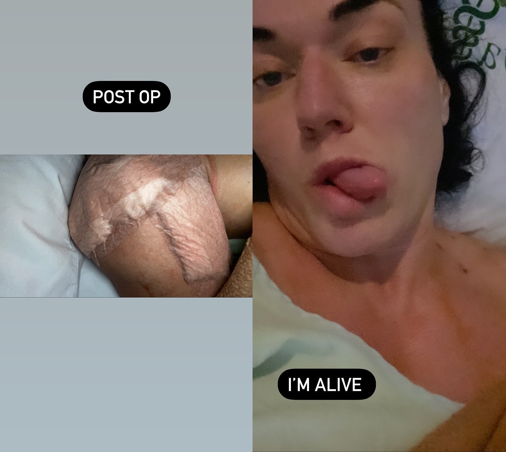 Вице-мисс Олимпия разорвала плечо дважды и осталась в Мексике - Бодибилдинг форум AnabolicShops