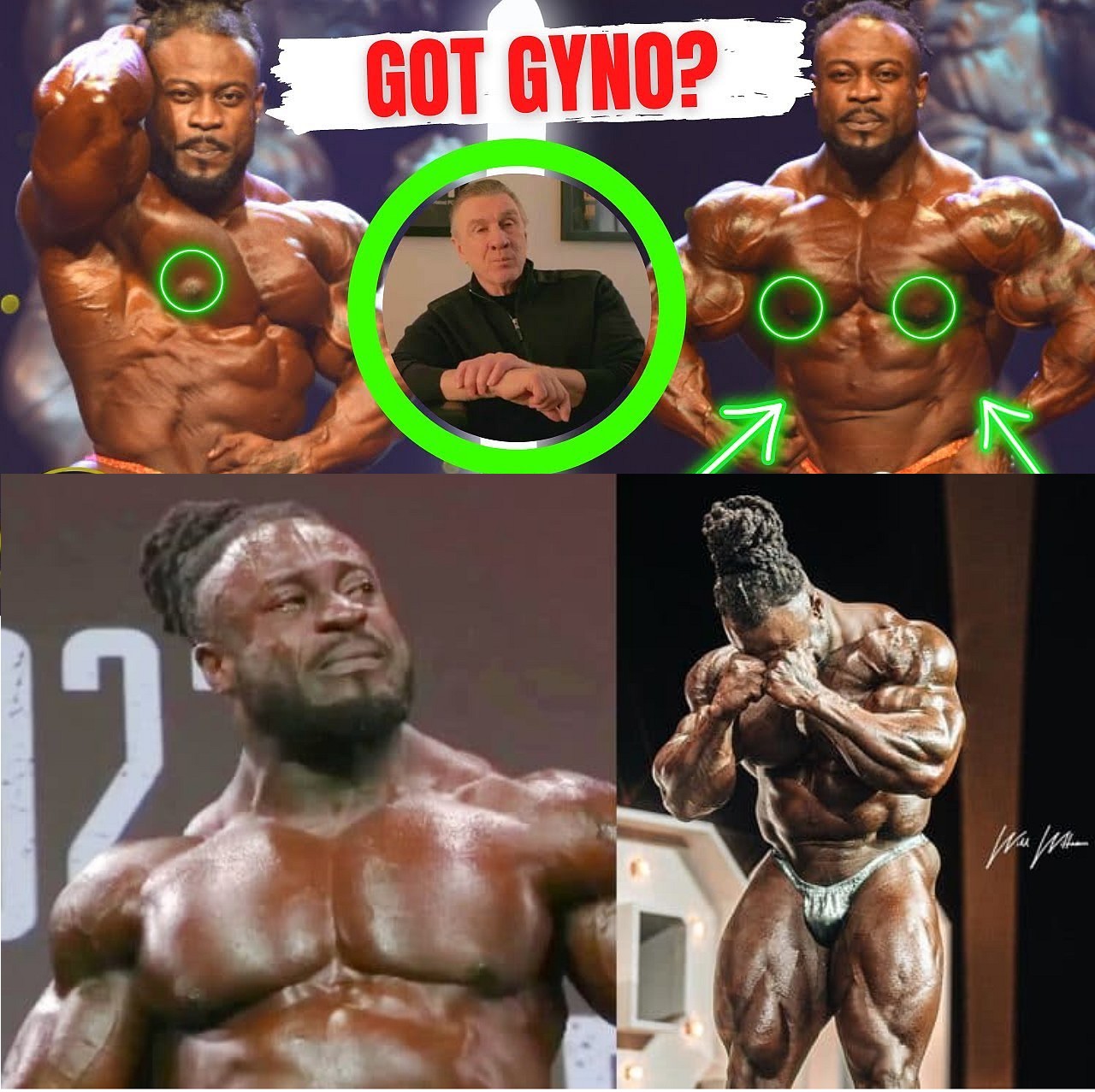 Рыдая Бонак идет на операцию по ампутации гинекомастии - Бодибилдинг форум AnabolicShops