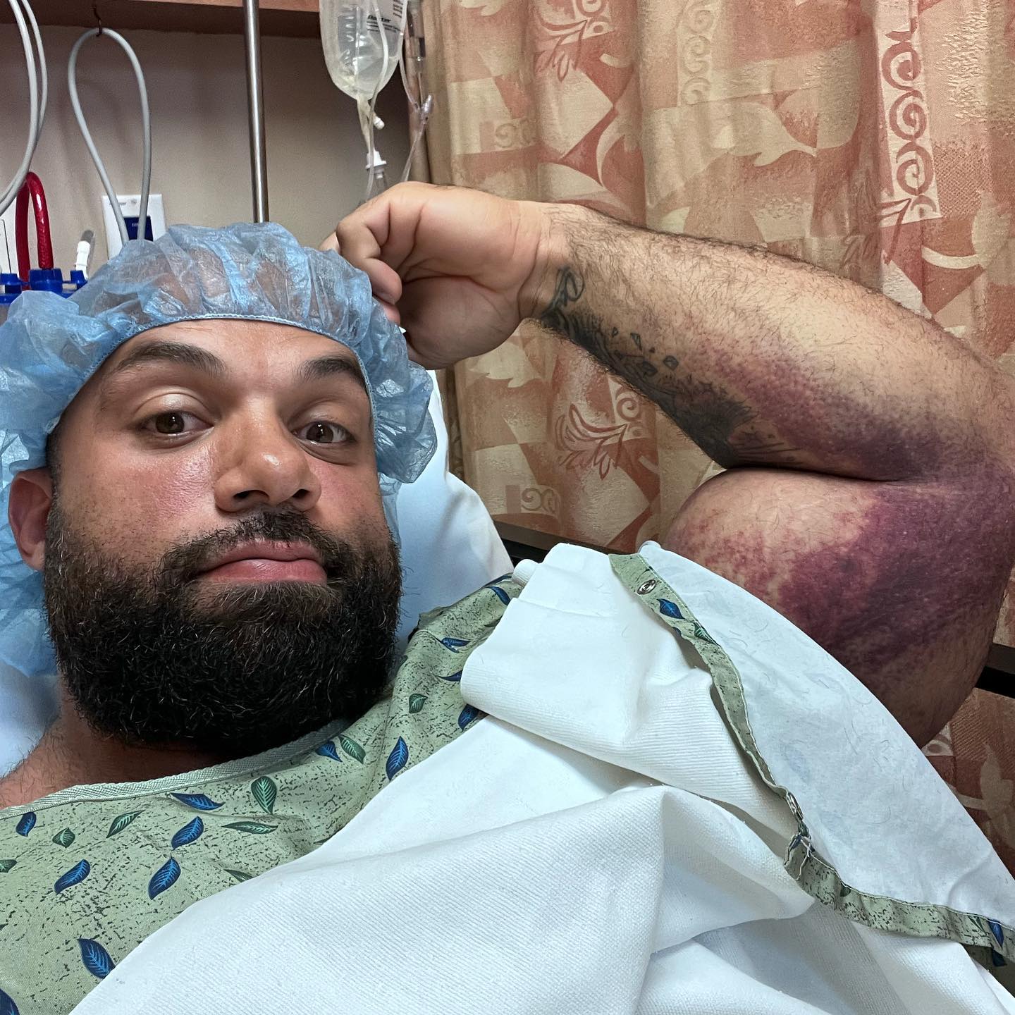 Собака порвала бицепс Джону ДеЛаРоса, он на операции - Бодибилдинг форум AnabolicShops