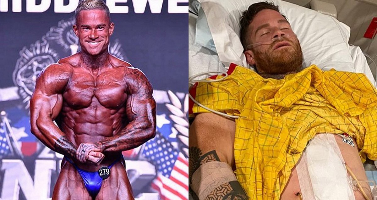 В IFBB Pro стреляли на глазах семьи. Врачи не удаляют пулю. Видео - Бодибилдинг форум AnabolicShops