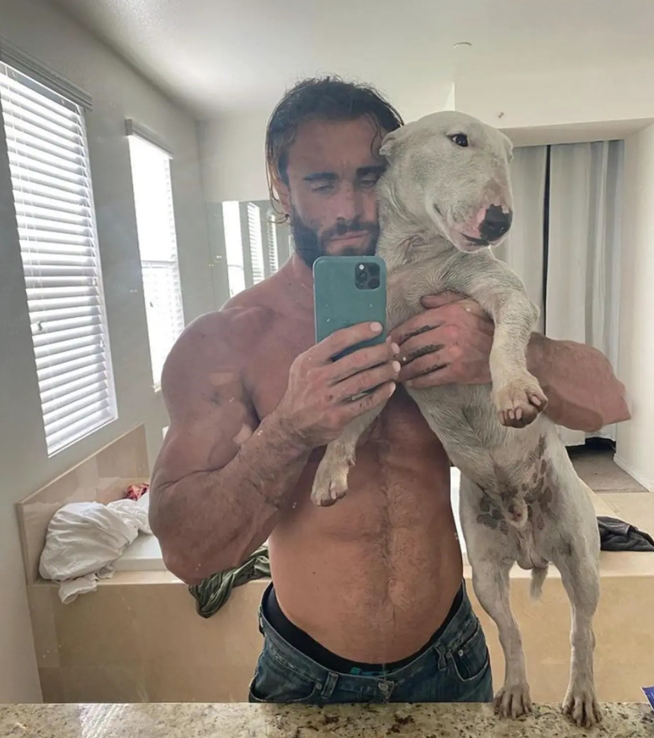 Что с Калумом фон Могером после вывода из комы и операции? - Бодибилдинг форум AnabolicShops