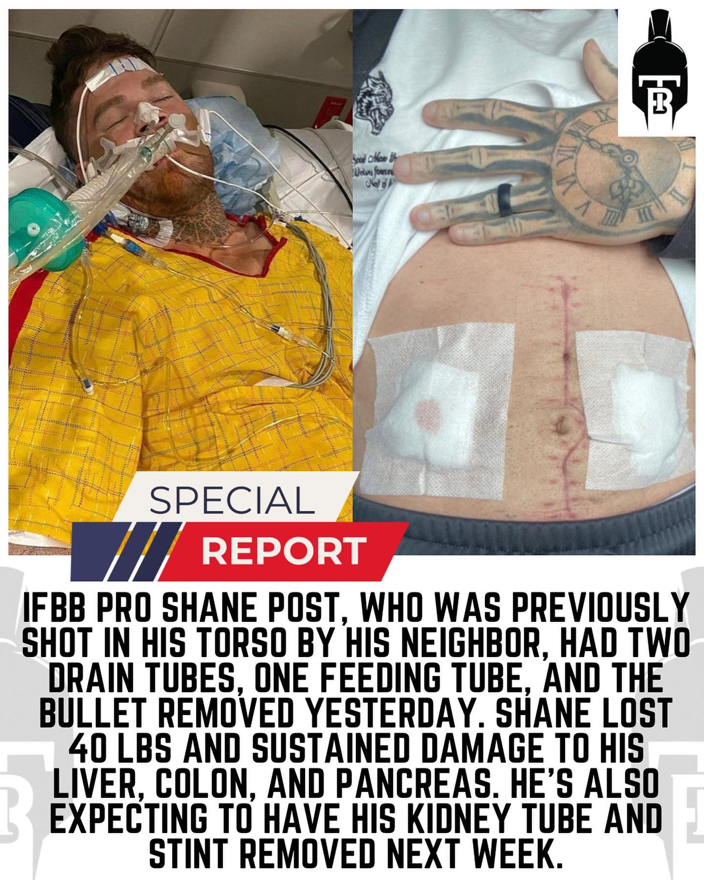 Судья лишился должности из-за дела о стрельбе в бодибилдера - Бодибилдинг форум AnabolicShops