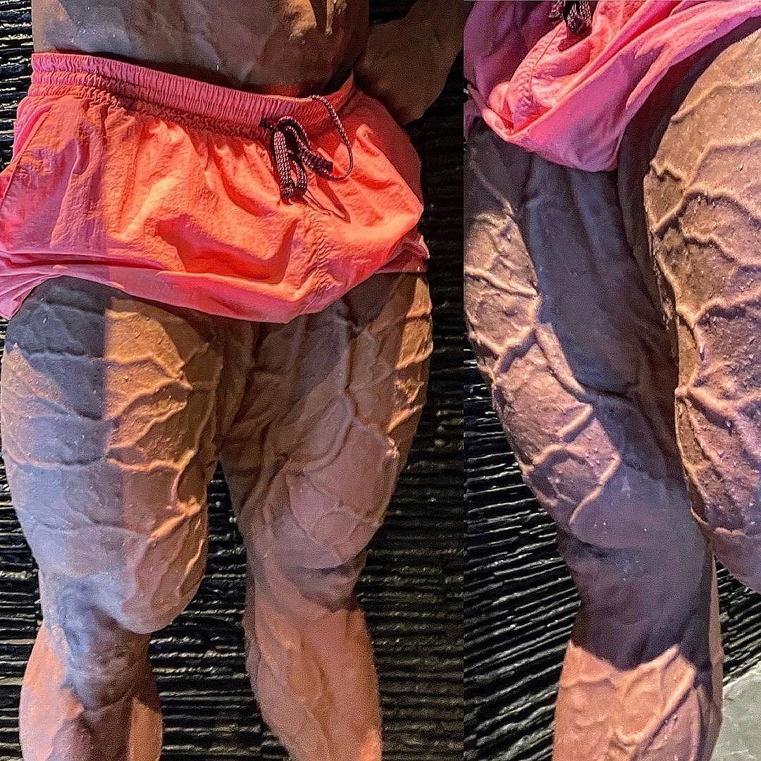 Влад Сухоручко шокировал фото венозных ног - Бодибилдинг форум AnabolicShops