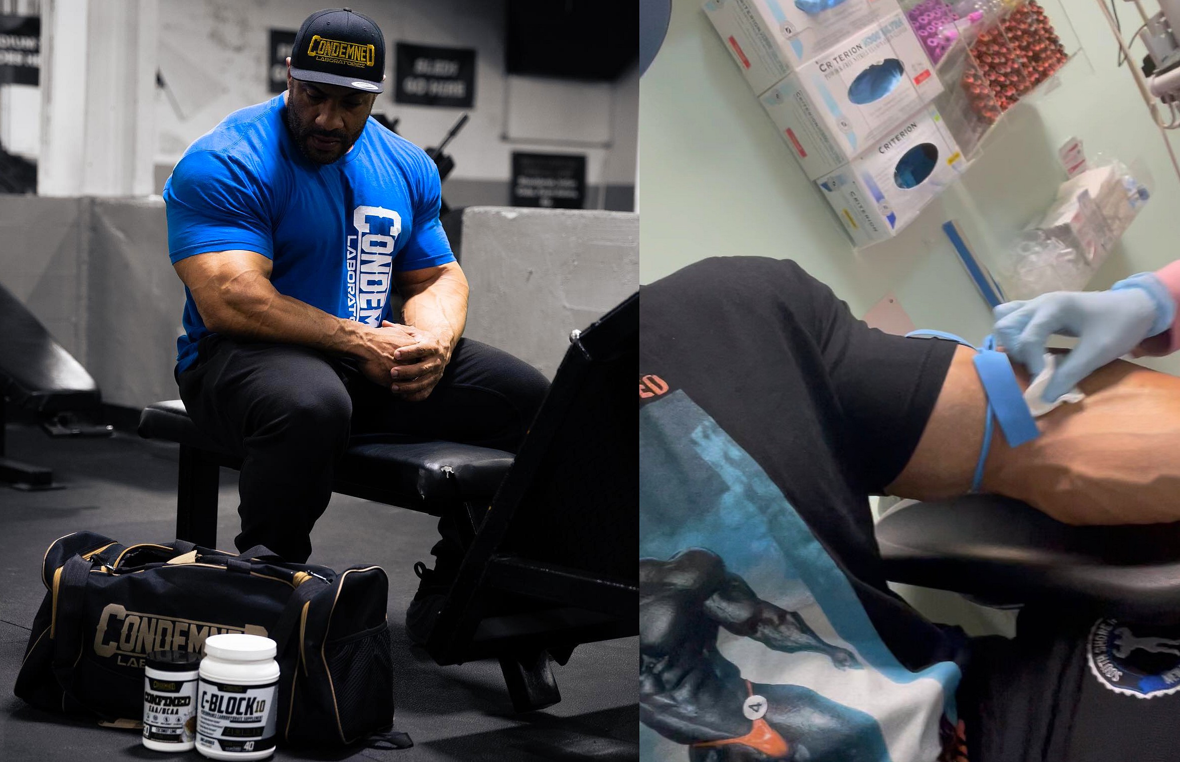 Почему «курс+мост» более опасны - мнение доктора - Бодибилдинг форум AnabolicShops