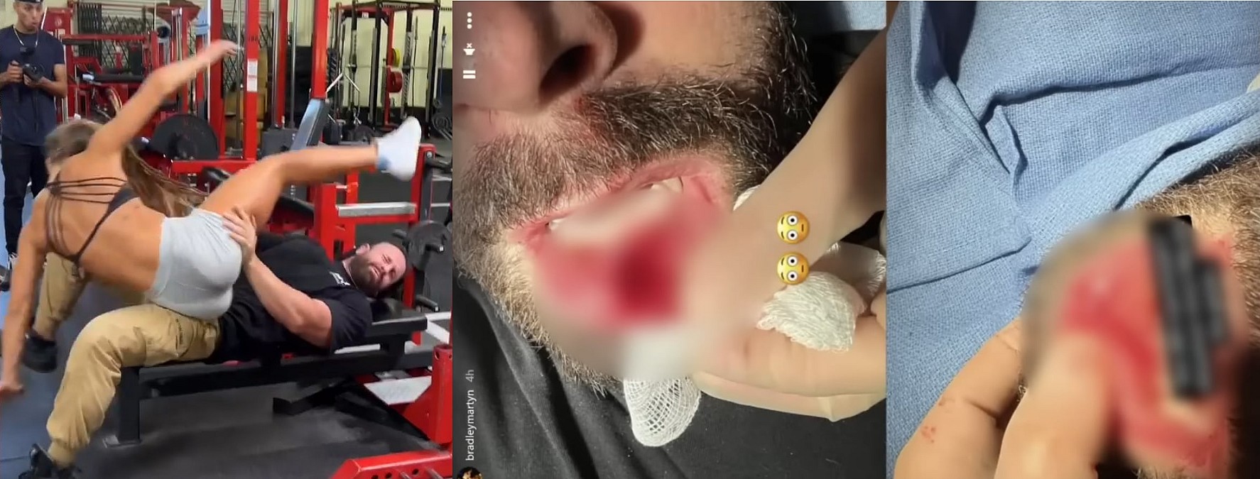 Женщина на лицо - причина 10 швов во рту на видео Брэдли Мартина - Бодибилдинг форум AnabolicShops