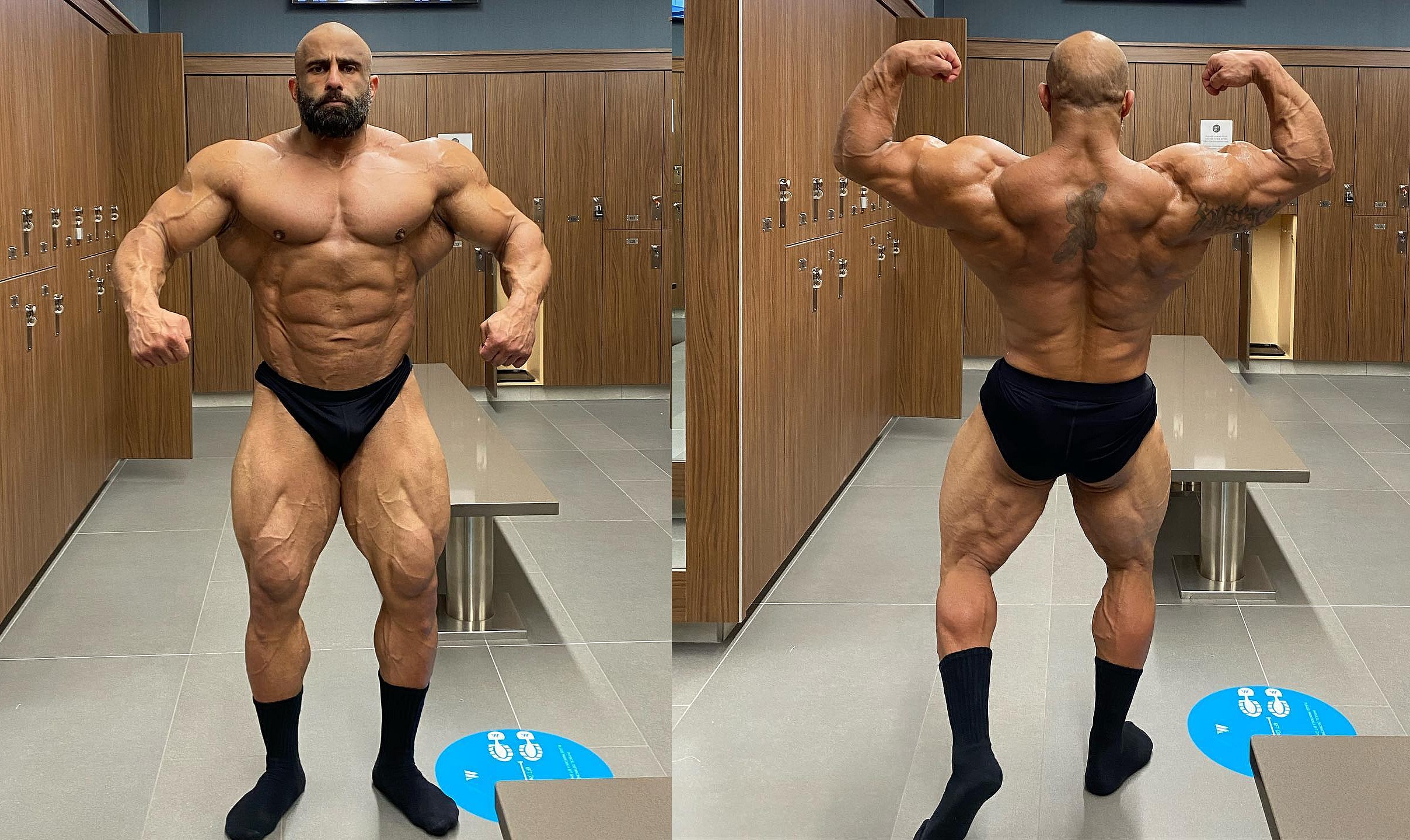 "Не хочу на диализ. Хочу быть со своей женой" - бодибилдер о причинах ухода - Бодибилдинг форум AnabolicShops