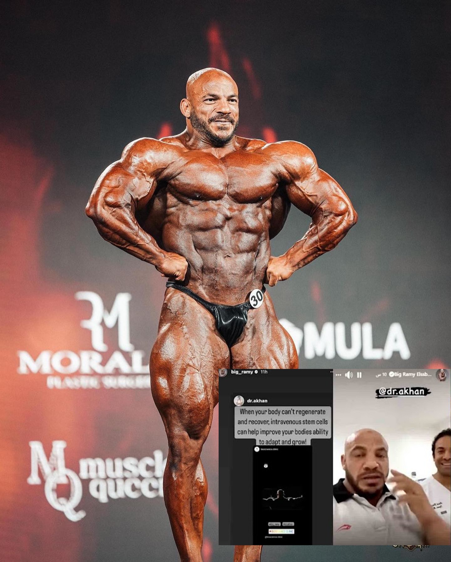 Альтернативное внутривенное лечение атрофированных нервов Биг Рами - Бодибилдинг форум AnabolicShops