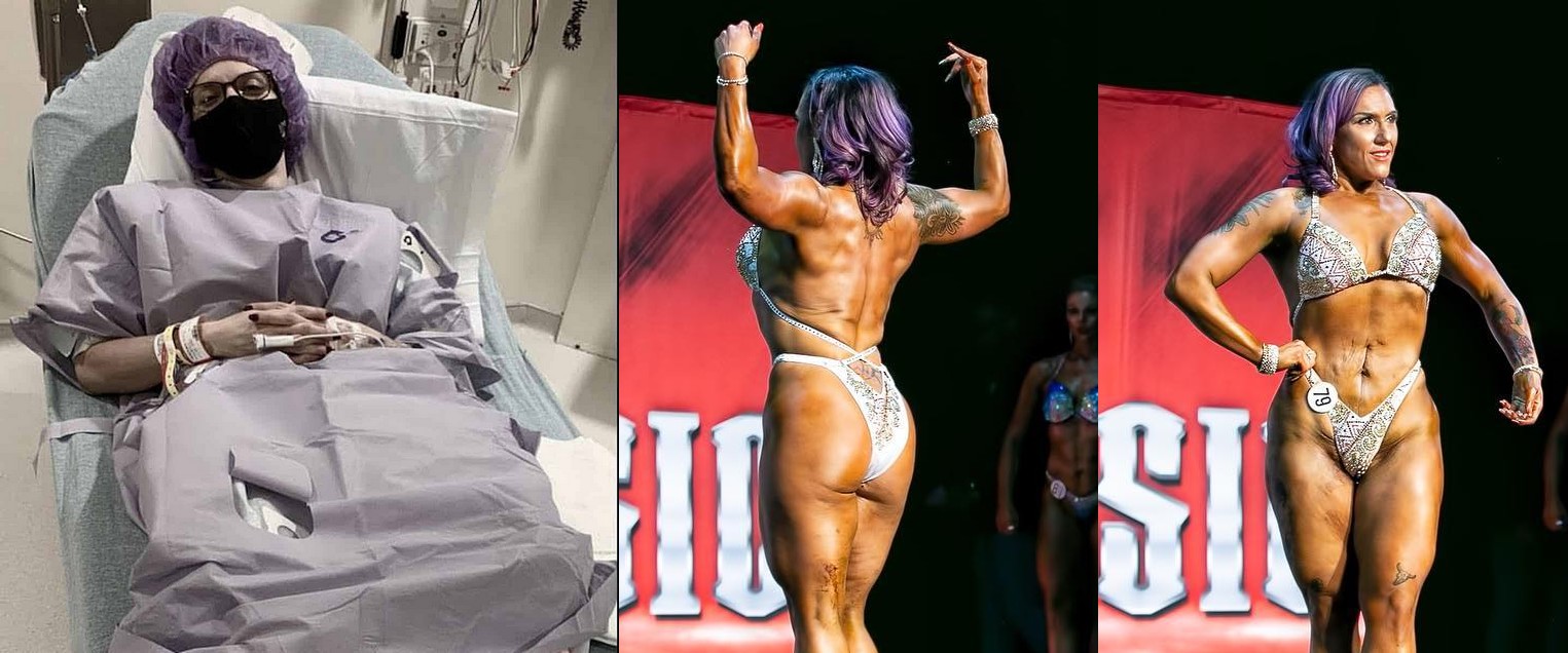 После рака почки занялась бодибилдингом и участвует в соревнованиях - Бодибилдинг форум AnabolicShops