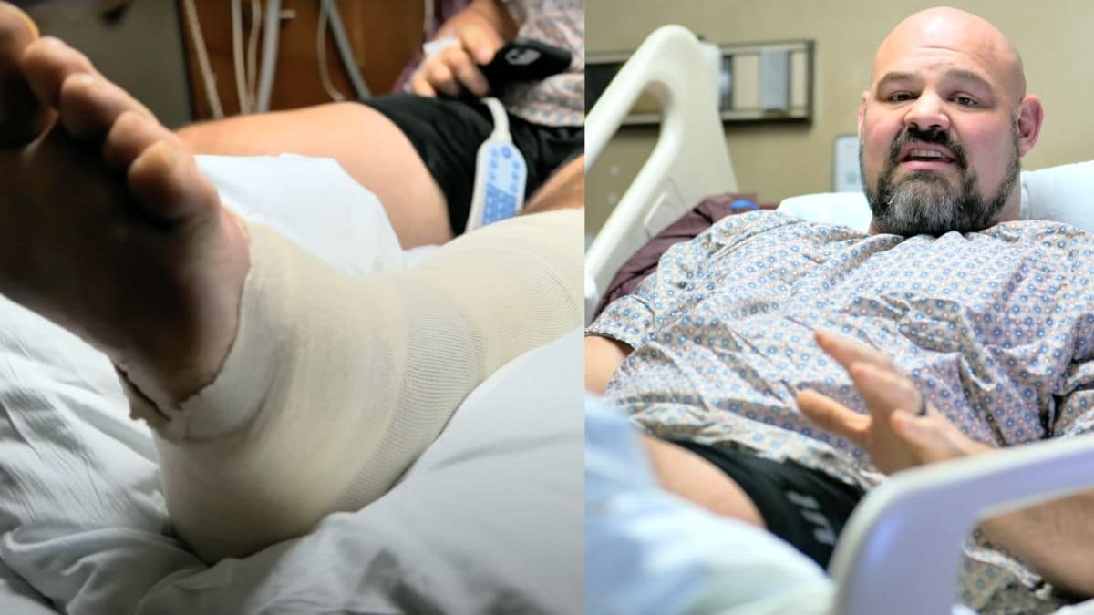 Борьба Брайана Шоу с тяжелым случаем целлюлита - Бодибилдинг форум AnabolicShops