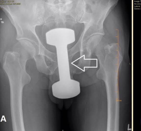 Анекдоты обо всем - Бодибилдинг форум AnabolicShops