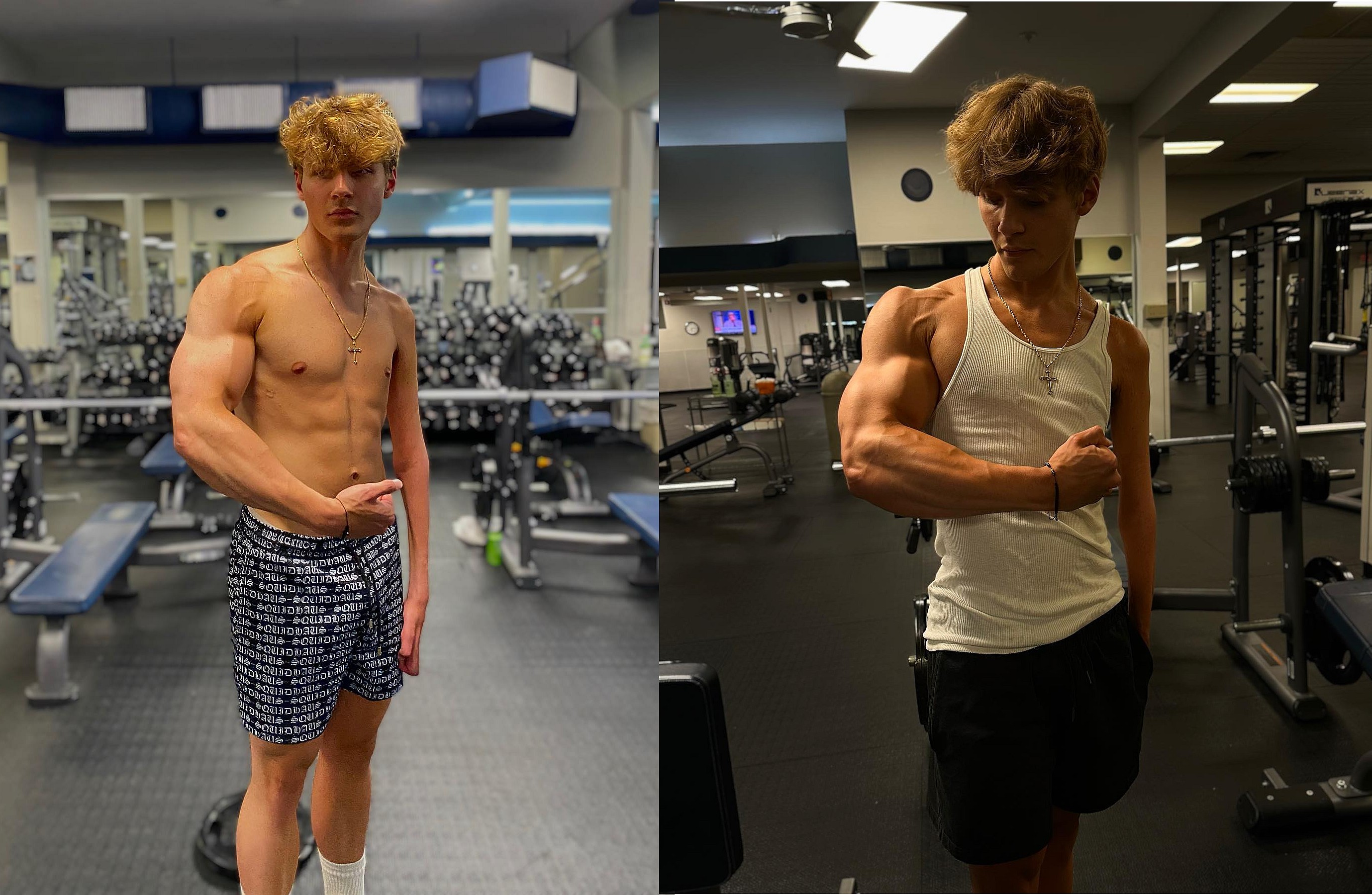 Накачался после комы с парализованной рукой в 19 лет - Бодибилдинг форум AnabolicShops