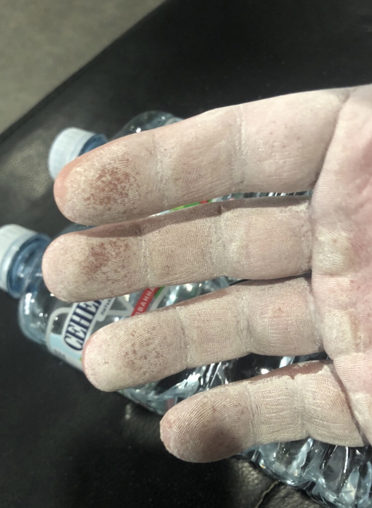 Hilma PRO - с заботой о вашем здоровье! - Бодибилдинг форум AnabolicShops