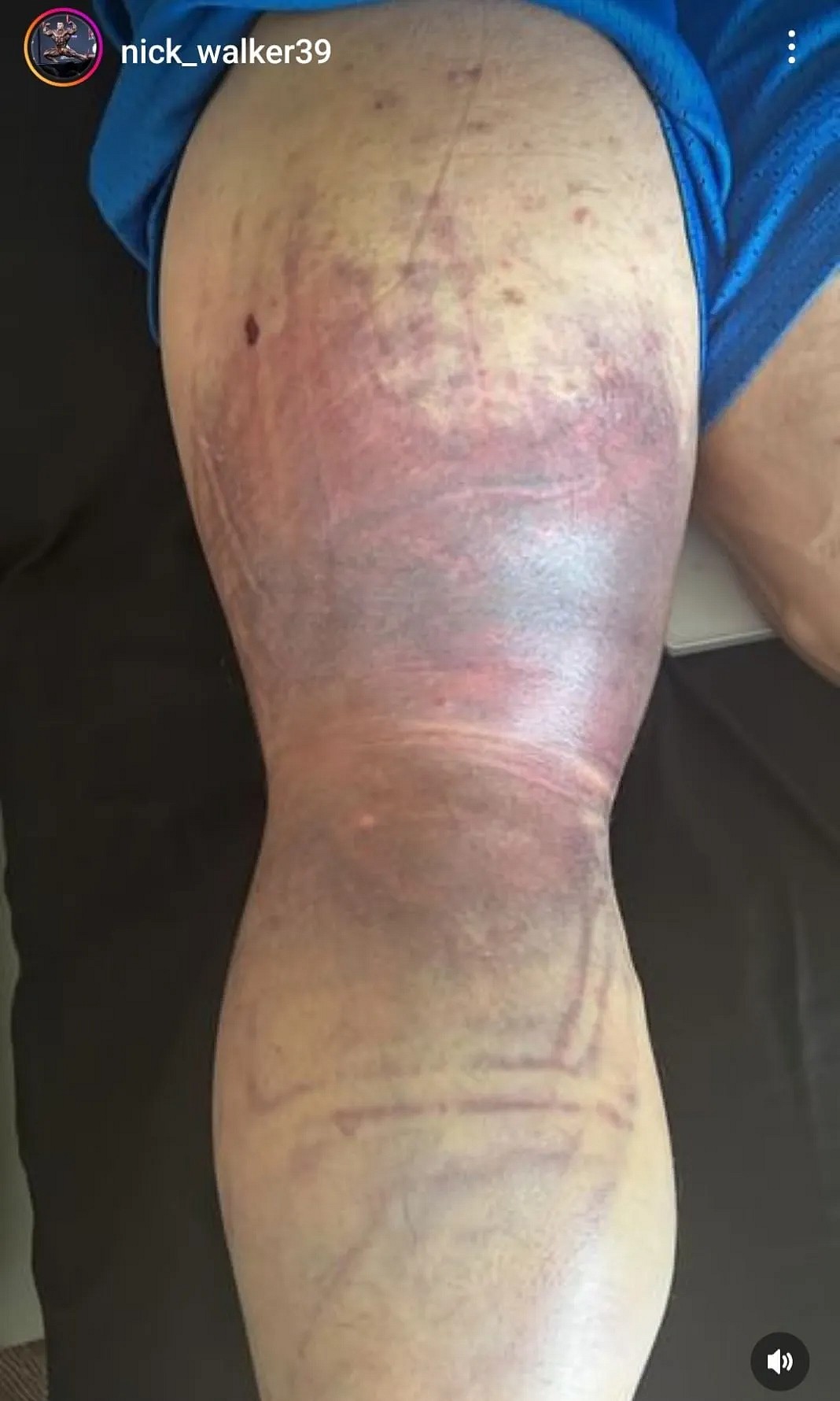 Бронзовый призер Ник Уокер снят с Olympia 2023 - Бодибилдинг форум AnabolicShops