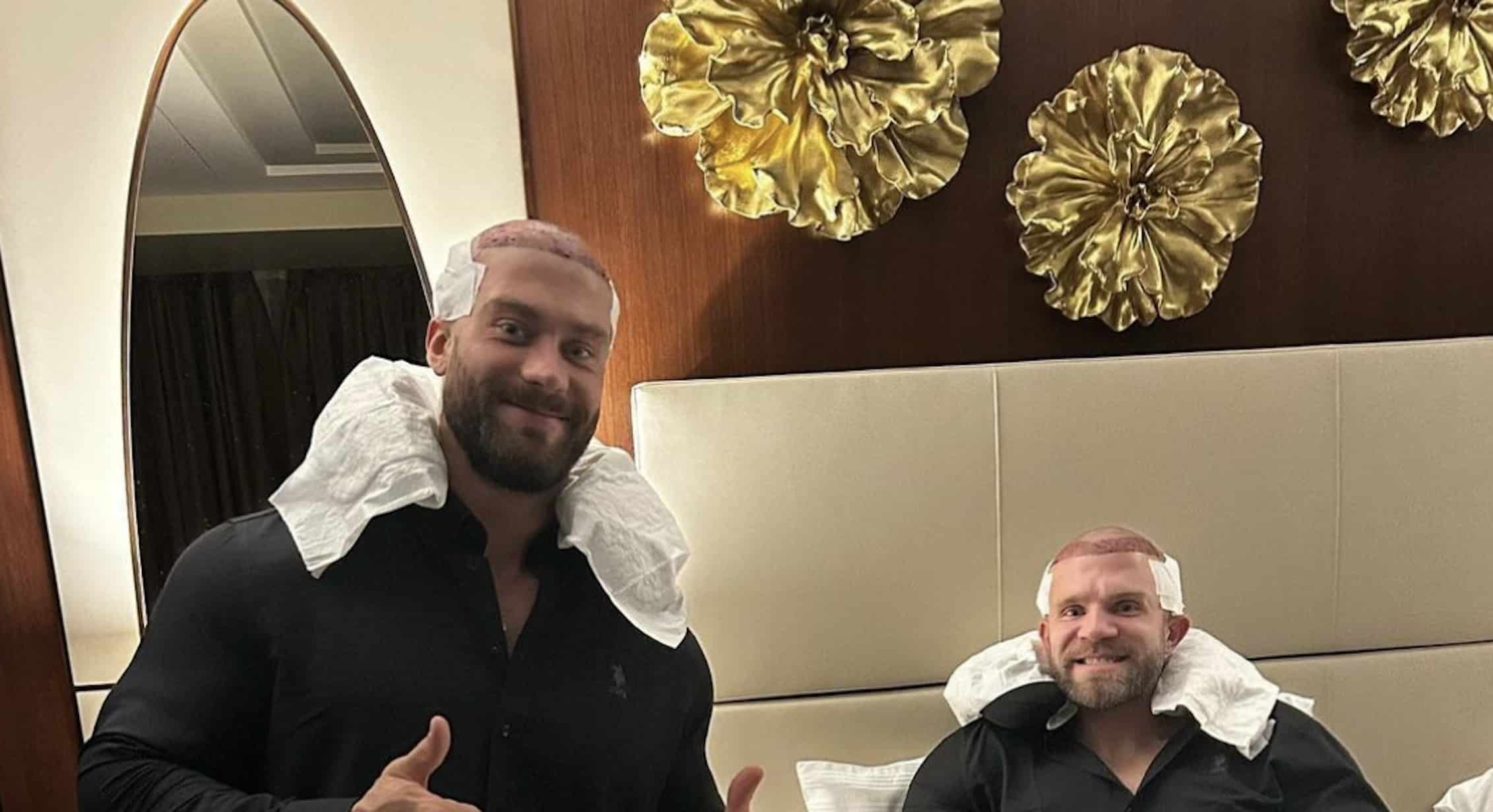 Крис Бамстед и Йен Валлир пересадили волосы - Бодибилдинг форум AnabolicShops