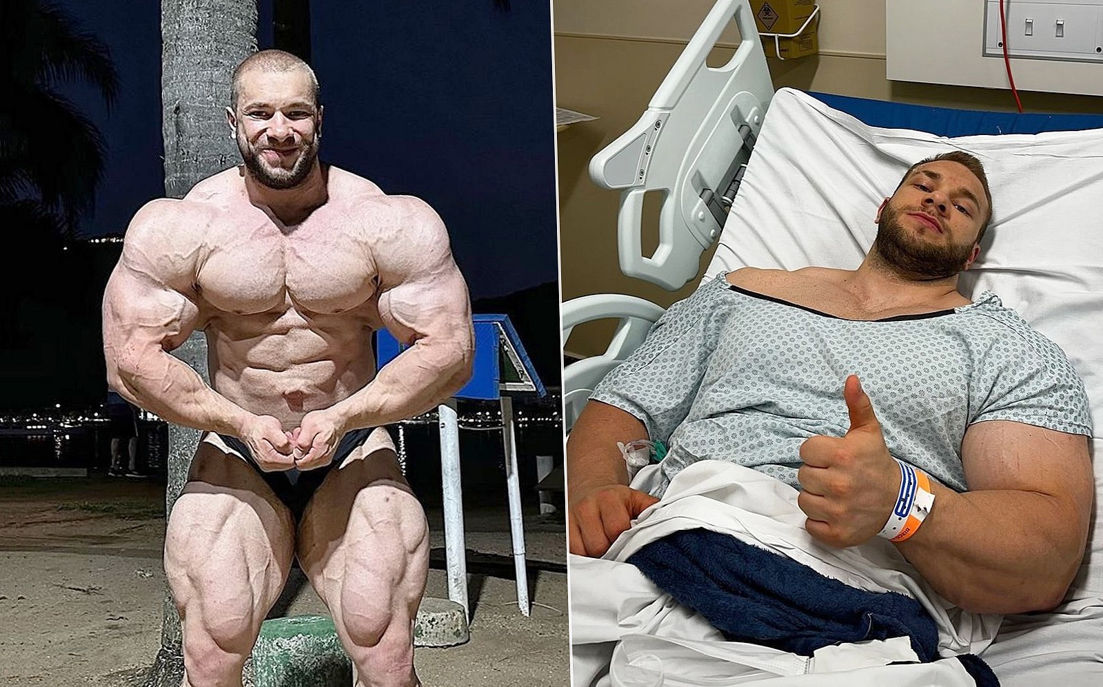 Виталий «Good Vito» Угольников из операционной: «Надеюсь выздороветь как можно скорее» - Бодибилдинг форум AnabolicShops