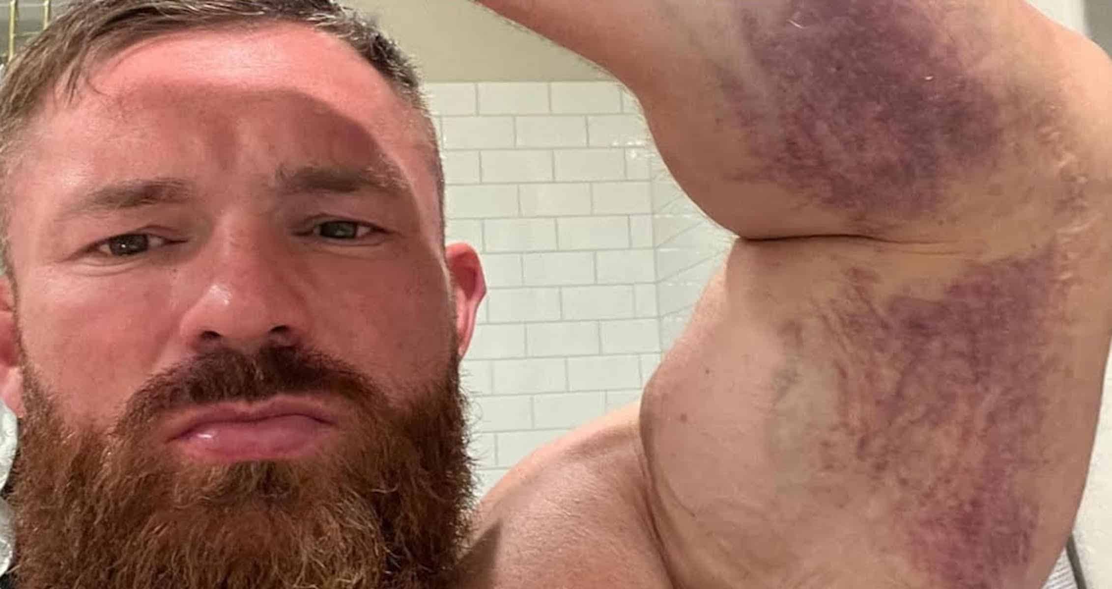 Флекс Льюис оторвал сухожилие трицепса от кости. Видео - Бодибилдинг форум AnabolicShops