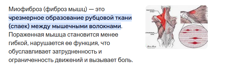 Тестостерона ундеканоат (Небидо). Всё,  что вы хотели знать, но не знали,  у кого спросить. - Бодибилдинг форум AnabolicShops