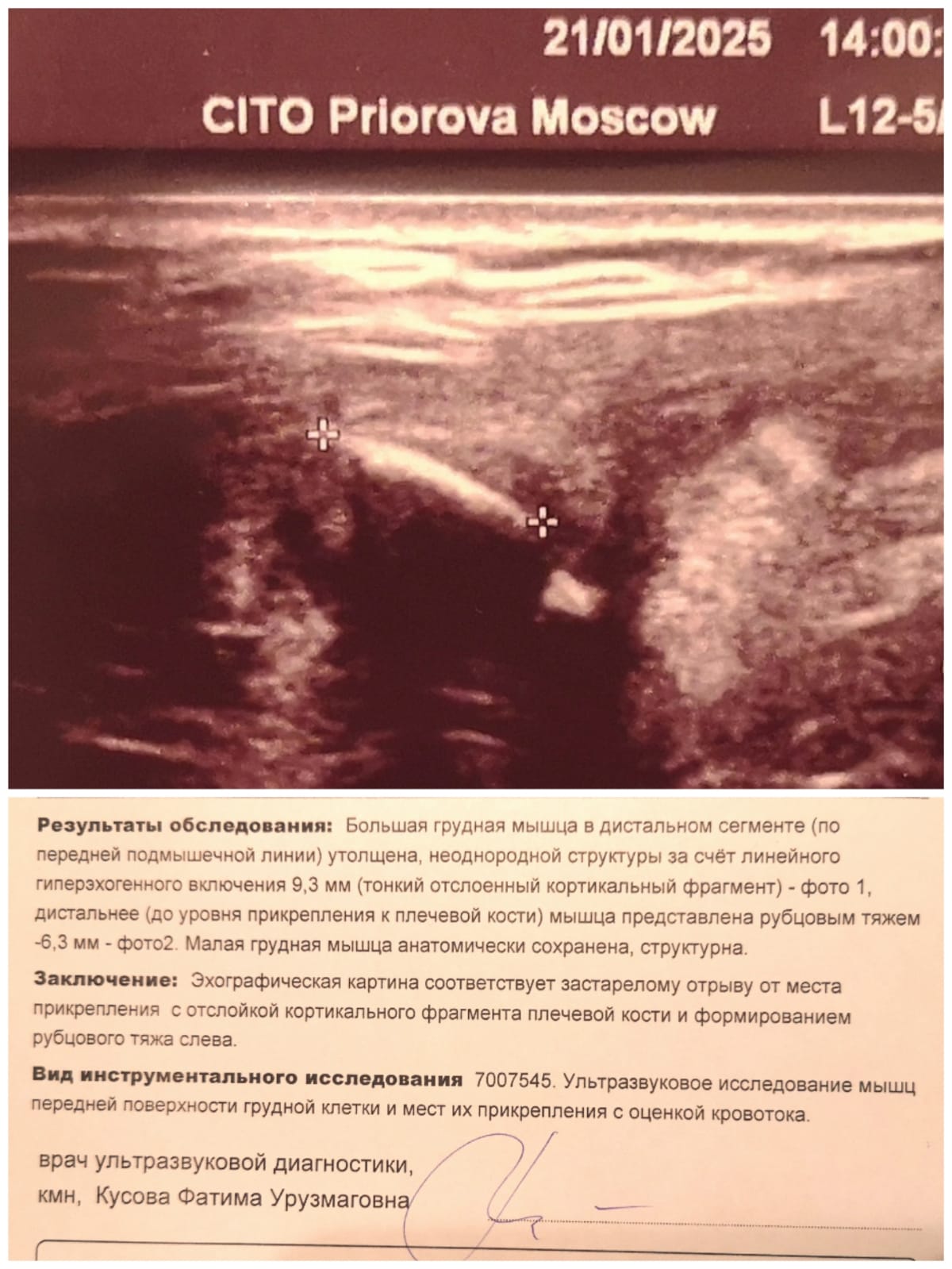 *** Лиса*** - Бодибилдинг форум AnabolicShops