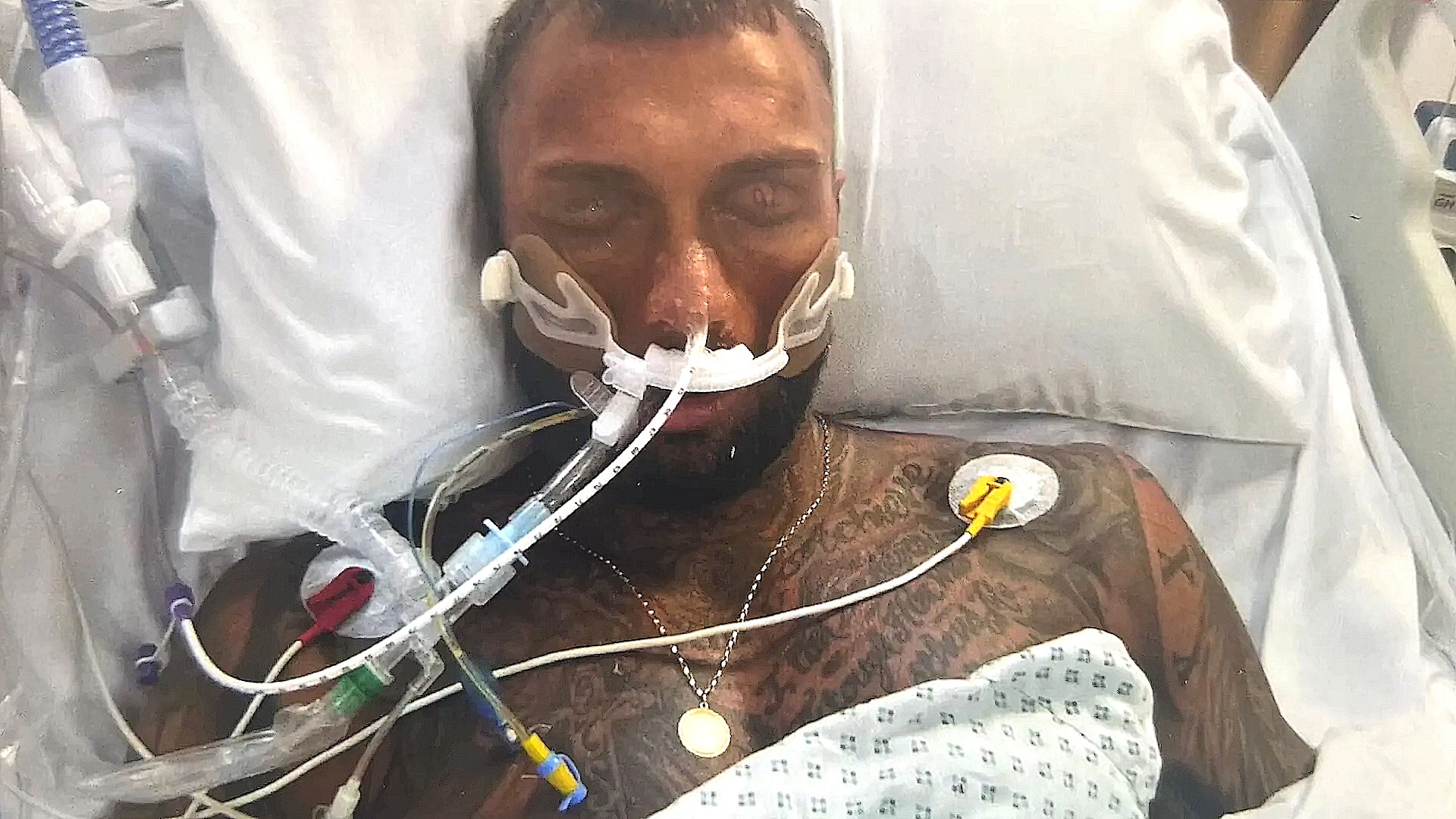 Потратил более $46000 на стероиды и впал в кому - Бодибилдинг форум AnabolicShops